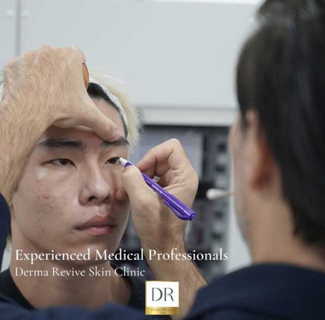 黄金射频微针 RF-Microneedling - Derma Revive Skin Clinic 伦敦医美中心