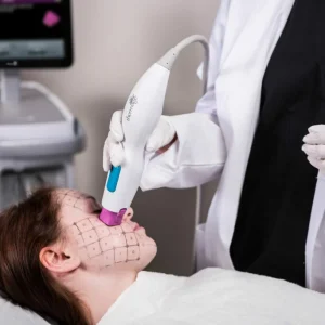 Woman having Thermage treatment on her face